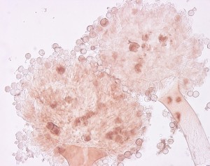 Aspergillus carbonarius